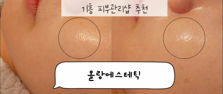  기흥 올랑에스테틱 수분폭탄관리 가격, 찐 후기