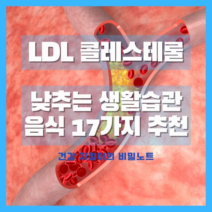  LDL 콜레스테롤 낮추기, 나쁜 콜레스테롤 낮추는 생활습관, 음식 17가지 추천