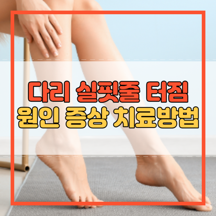  다리 실핏줄 터짐 원인 증상 치료방법 핏줄 예방법!