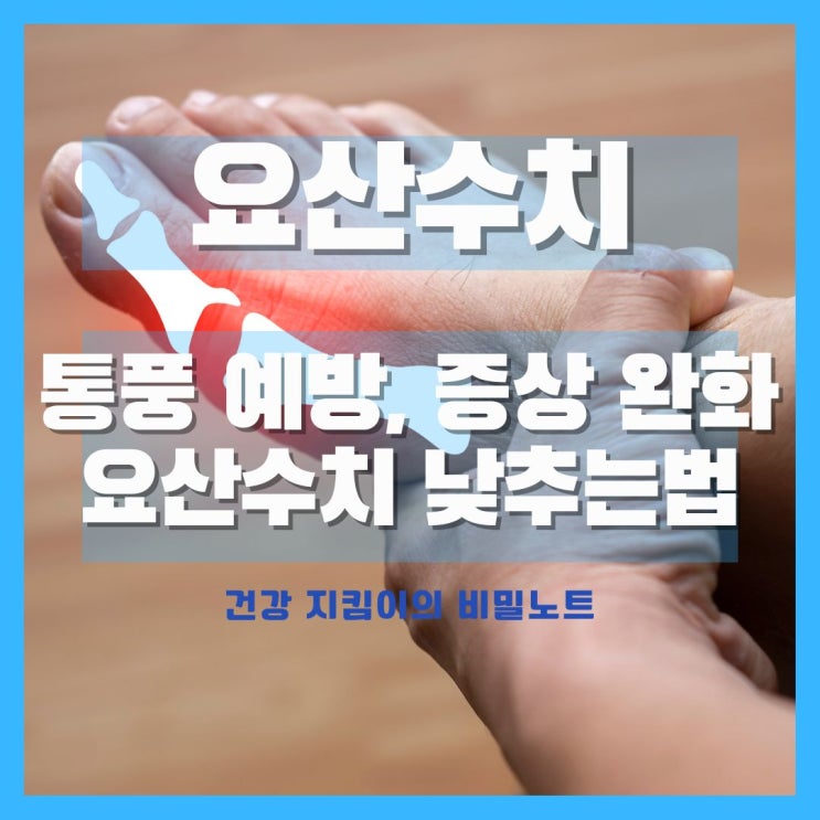  통풍 요산수치 낮추는법 알아보기