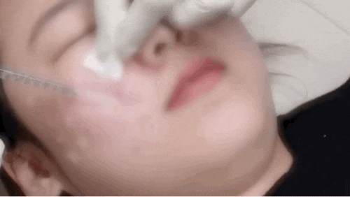 센텀 리쥬란힐러 맞아도 효과 하나도 없다고? 센텀 리쥬란힐러 맞아도 효과 하나도 없다고?