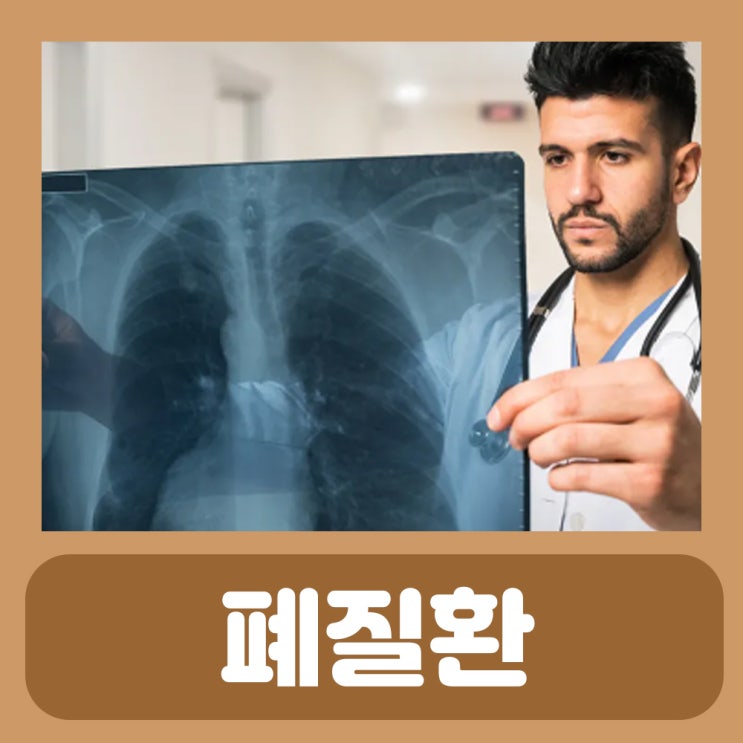  가슴답답 호흡곤란 원인 진폐증 왼쪽 오른쪽 폐통증 폐질환 증상 가슴답답함