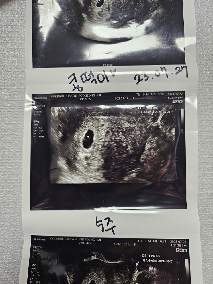  임신 12주차 정밀초음파 후기. 임밍아웃!