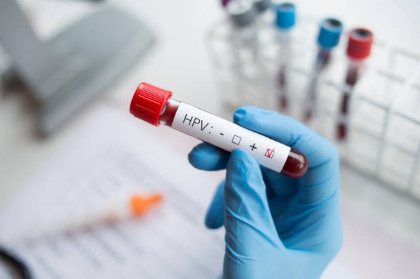  강남 산부인과 자궁경부 이형성증 원인과 HPV 감염 경로
