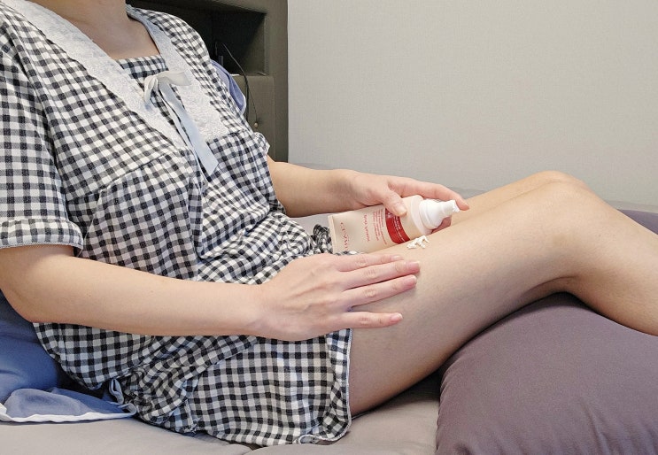 허벅지 튼살제거 클라랑스튼살크림 하나만 있으면 걱정없어! 허벅지 튼살제거 클라랑스튼살크림 하나만 있으면 걱정없어!