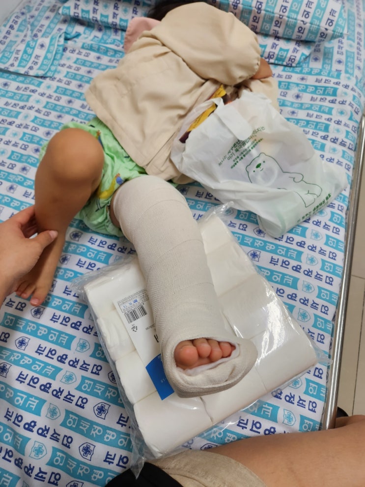 31개월아기 다리골절 병원2군데 방문후기[병원고르는팁][아이가 다쳤을때 처지방법]