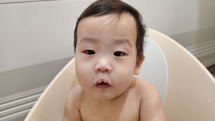  [11개월]아데노바이러스 초기증상/아기 약먹이기 팁/항생제/38도/집에서 치료
