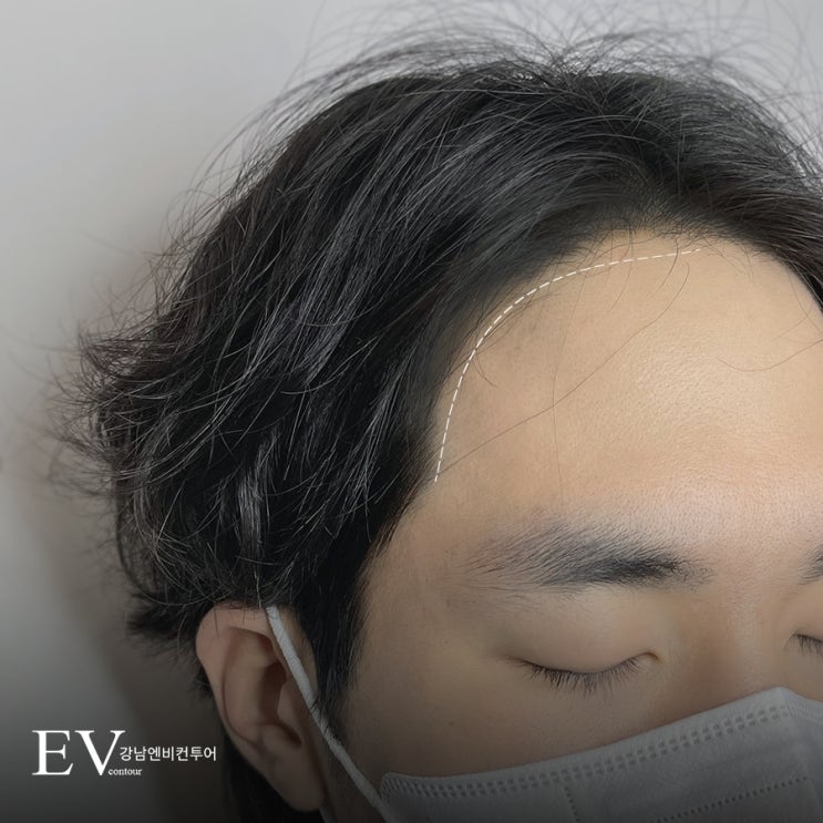  남자 헤어라인문신 가격 부담 없이 받자