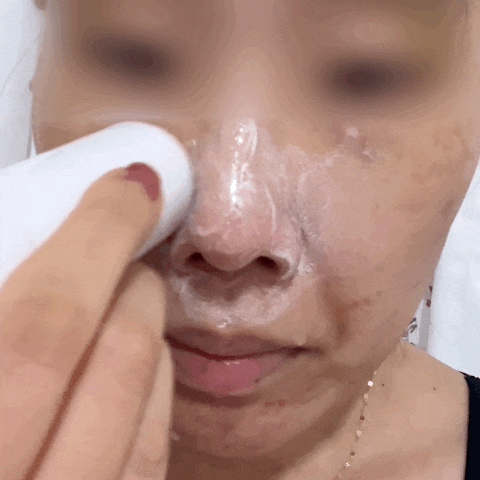 메디필 블랙헤드연화스틱 엑스트라 슈퍼9 플러스 액티브 스틱 묵은각질 피지관리