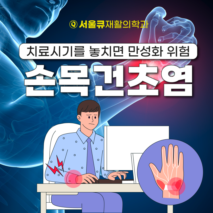 석촌역정형외과, 손목건초염 치료시기를 놓치면 만성화 위험
