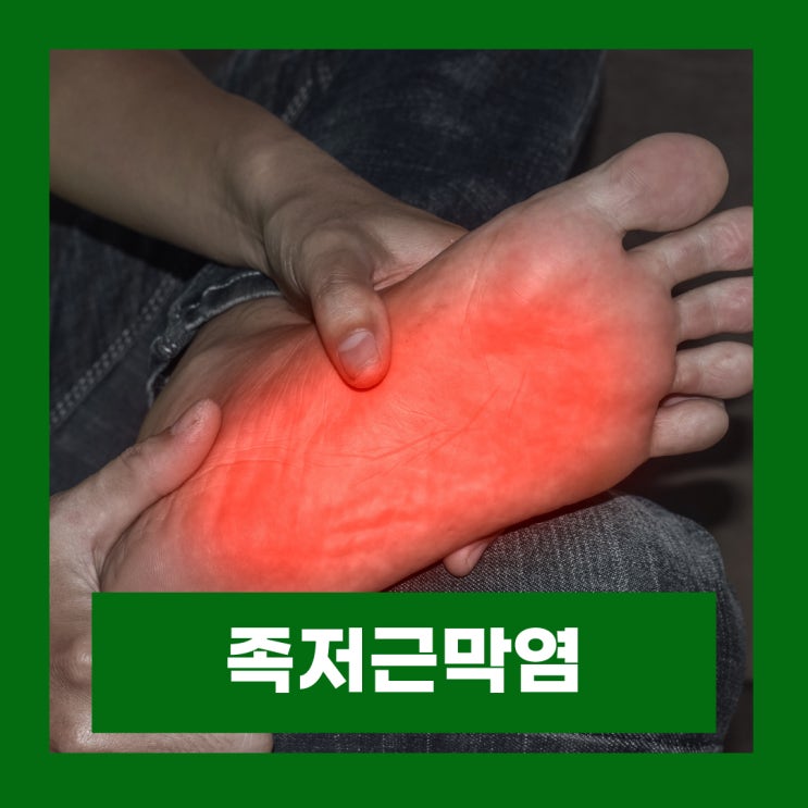  발바닥 통증 족저근막염 증상 및 원인 예방방법과 치료법 알아보기