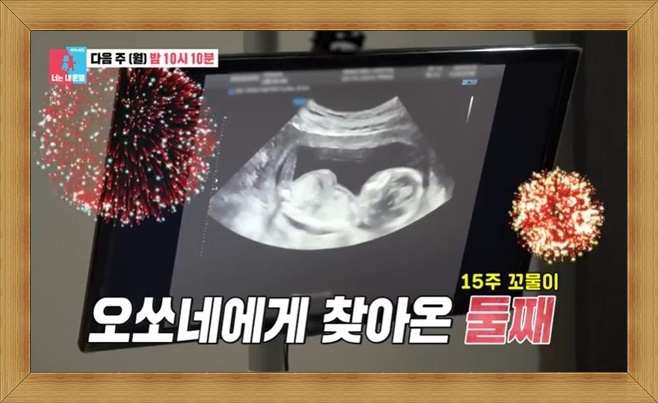 오상진과 김소영 부부, 둘째 임신 소식과 건강식 부부싸움