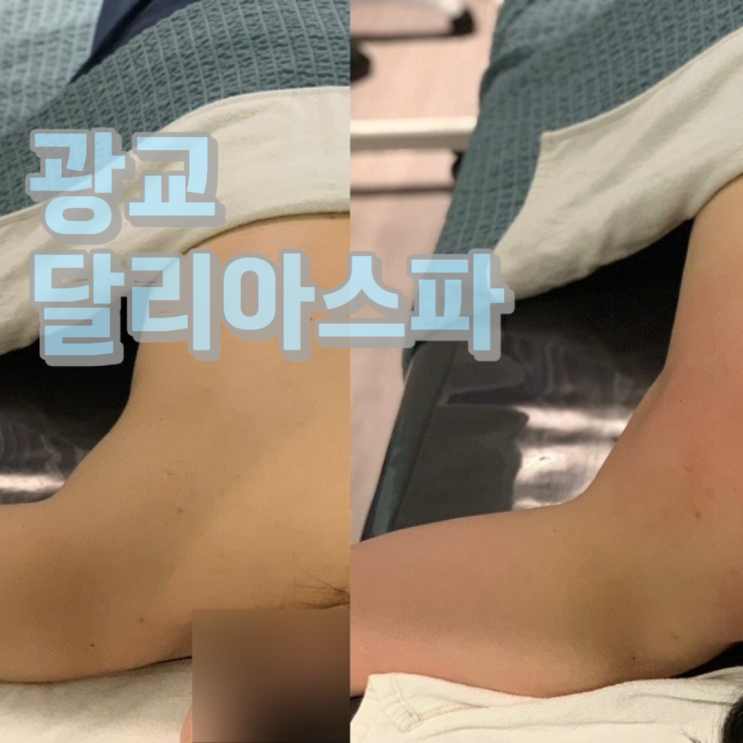  달리아스파광교중앙역점에서 웨딩관리 후기 및 약손명가와 비교