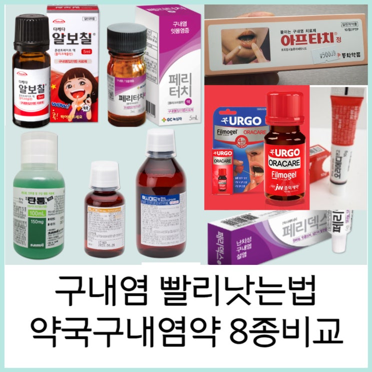  구내염 빨리낫는법? 약국 구내염약 8종비교(알보칠,오라메디,페리덱스,아프타치 등등)