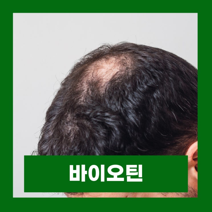  바이오틴 탈모샴푸 모발을 강하게 만들어 주는 성분 알아보기