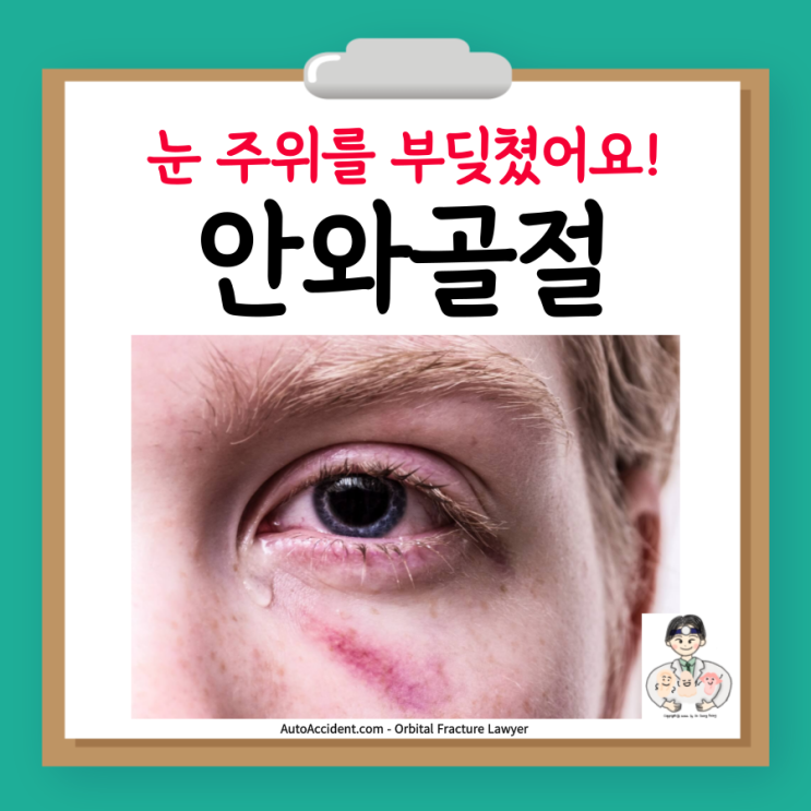  안와골절, 원인 증상 검사 수술 병원