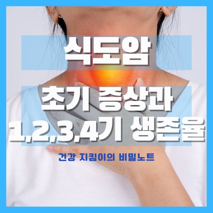  식도암 초기증상과 1기,2기,3기,4기 생존율