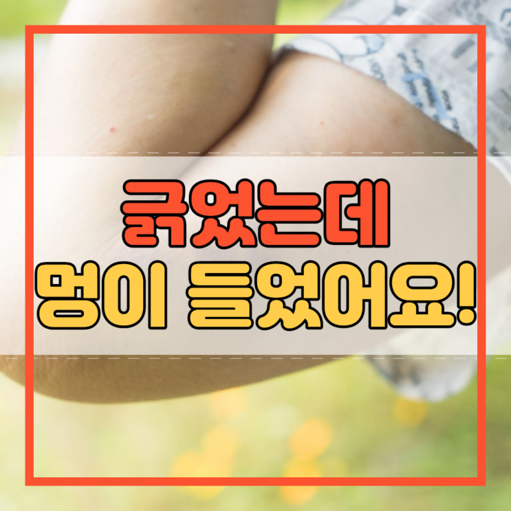  긁으면 멍 생기는 이유와 긁었는데 멍 들었다면 마사지!