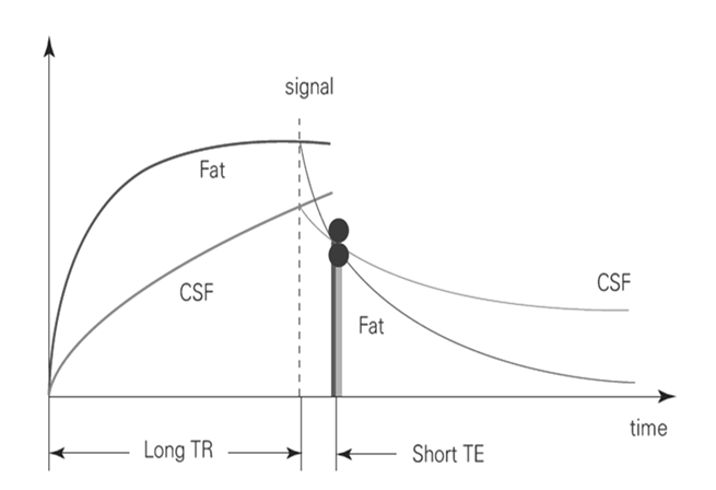 MRI medical physics (T1, T2, PD 강조영상) : 네이버 블로그