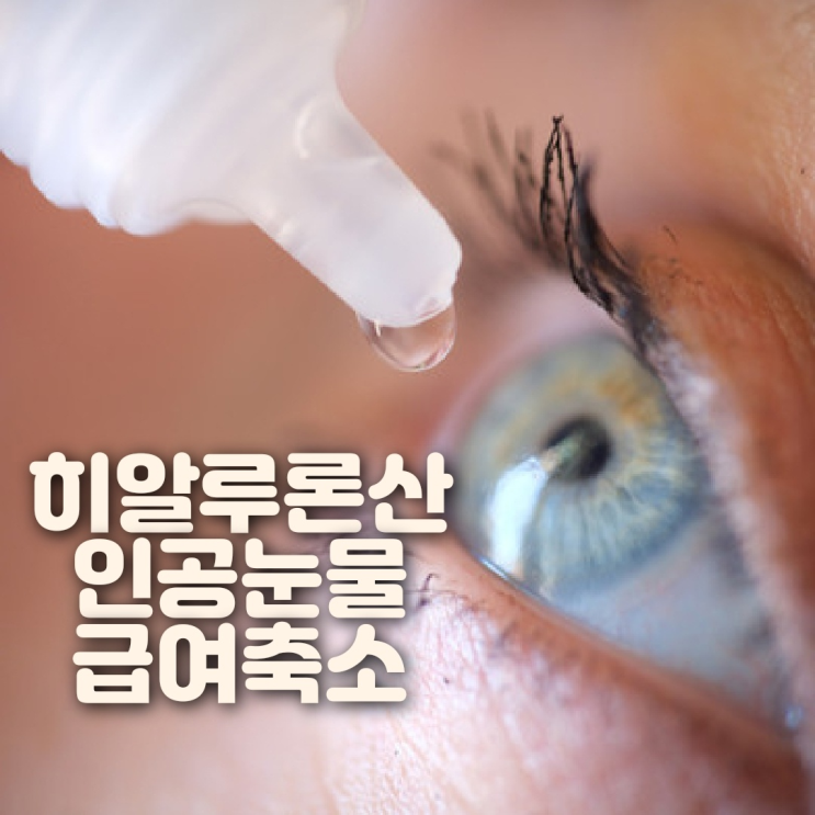  히알루론산 점안제 (인공눈물) 의료보험 급여축소