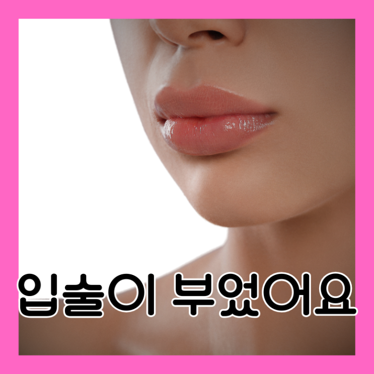  입술이 부었어요 원인 7가지