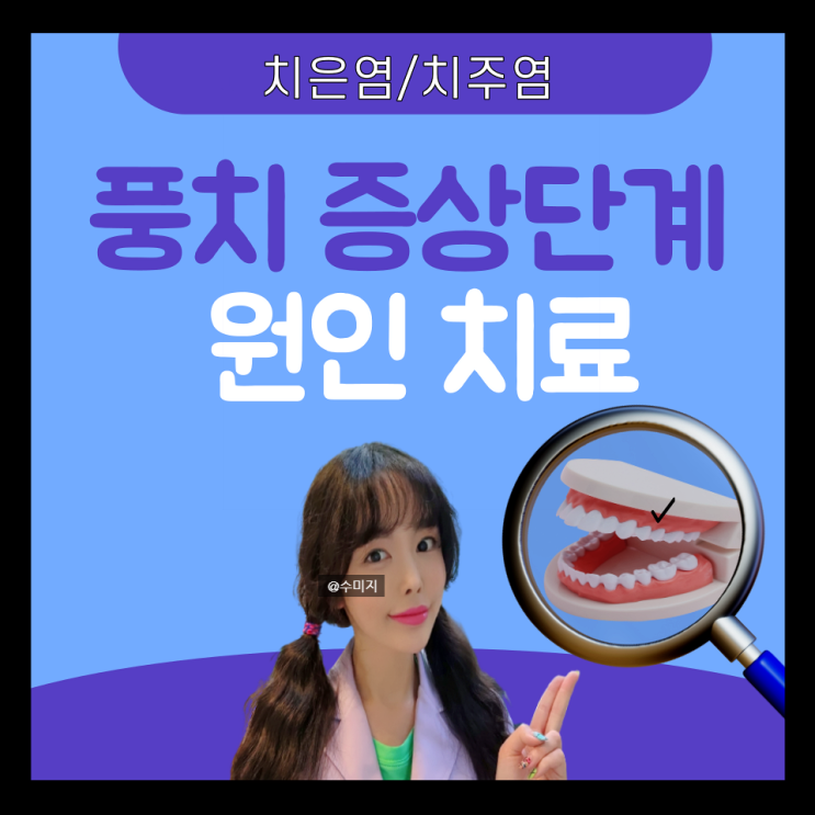  치주질환 : 치주염 치은염 잇몸 치아 염증 시림 풍치 원인 증상 치료