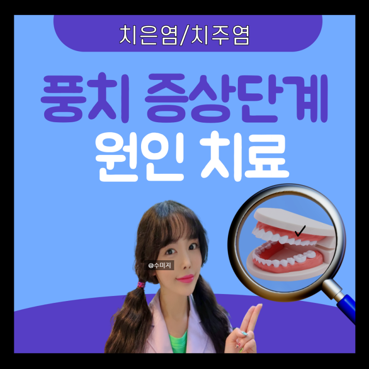 치주질환 : 치주염 치은염 잇몸 치아 염증 시림 풍치 원인 증상 치료