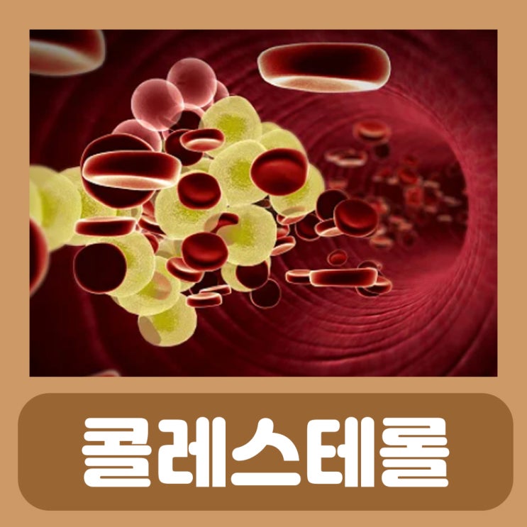  LDL HDL 나쁜 저밀도 좋은 고밀도 정상 콜레스테롤 수치