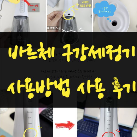  임신 시린이해결 바르체 구강세정기 물치실 사용방법 추천 후기