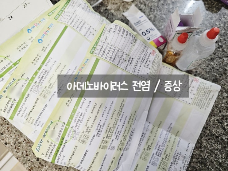 아데노바이러스 전염, 고열과 결막염 까지 똑같아