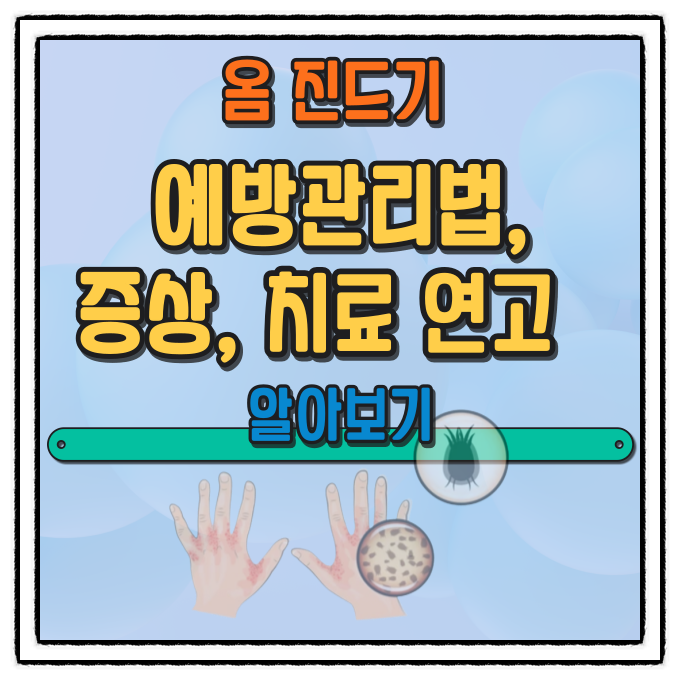  옴 예방관리법, 증상, 치료 연고 알아보기