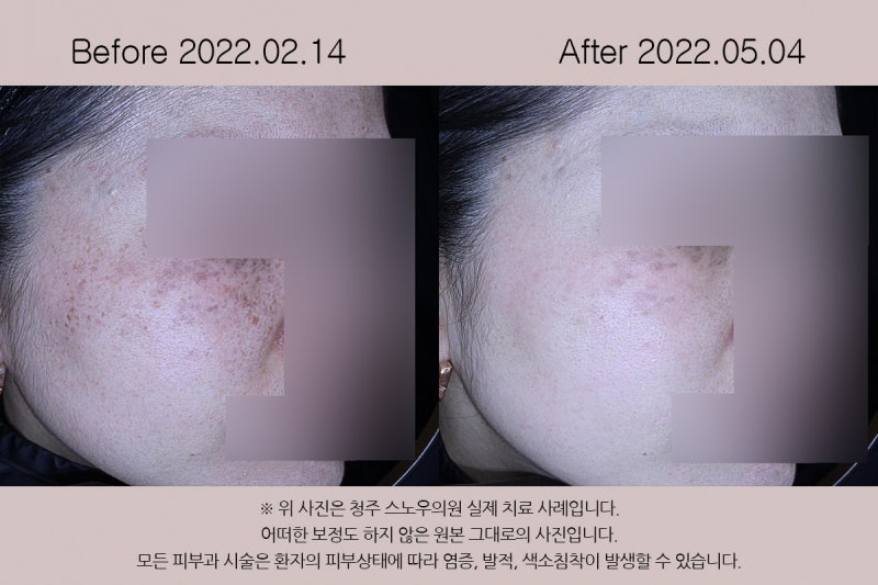 오창피부과, 절대 실패하지 않는 3가지 오창피부과, 절대 실패하지 않는 3가지