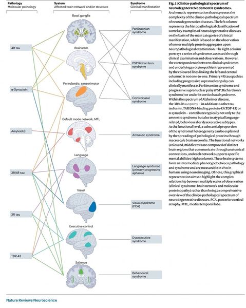  신경 퇴행성 질환의 커넥톰 기반 모델링: 정밀 의학과 기계론적 통찰력을 향해(Nature Reviews Neuroscience)