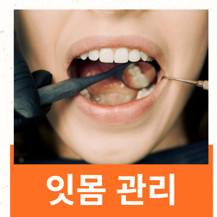 잇몸병 예방 치과의사가 알려주는 올바른 칫솔질 박창진 원장님