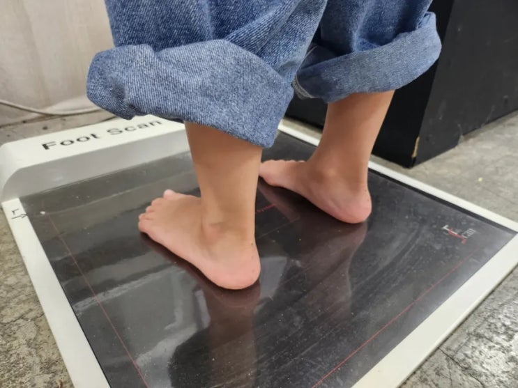  성장기의 유연성 평발 교정, 다리 길이 비대칭을 예방할 수 있습니다.