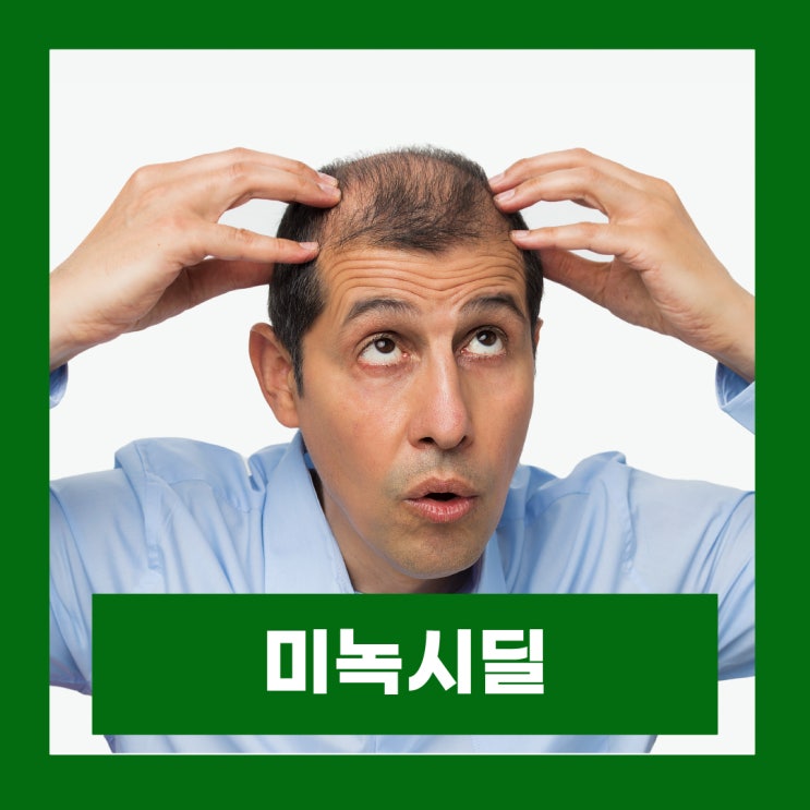  고혈압치료제 미녹시딜정 탈모치료제 미녹시딜 효과 부작용