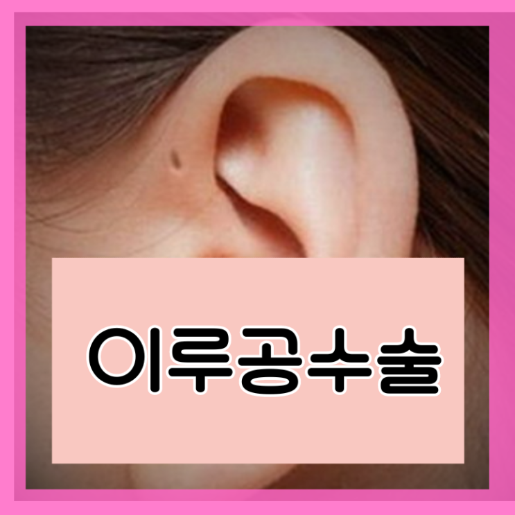  이루공수술 전이개누공 염증
