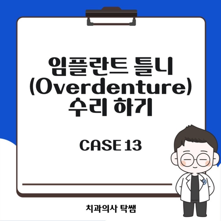  [탁쌤 CASE 13] 임플란트 틀니(overdenture) 수리해서 쓰기