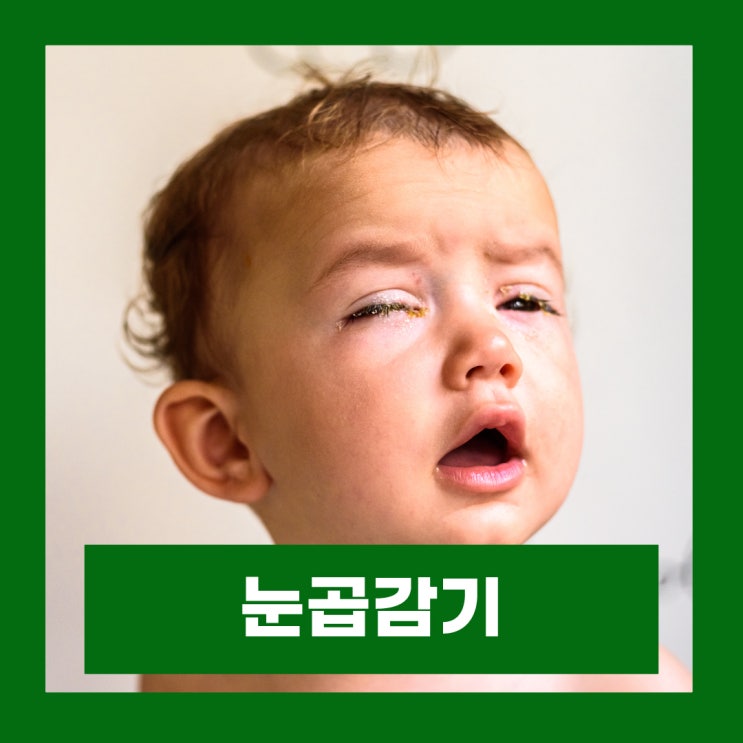  성인 아데노바이러스 전염 영유아 눈곱감기 증상