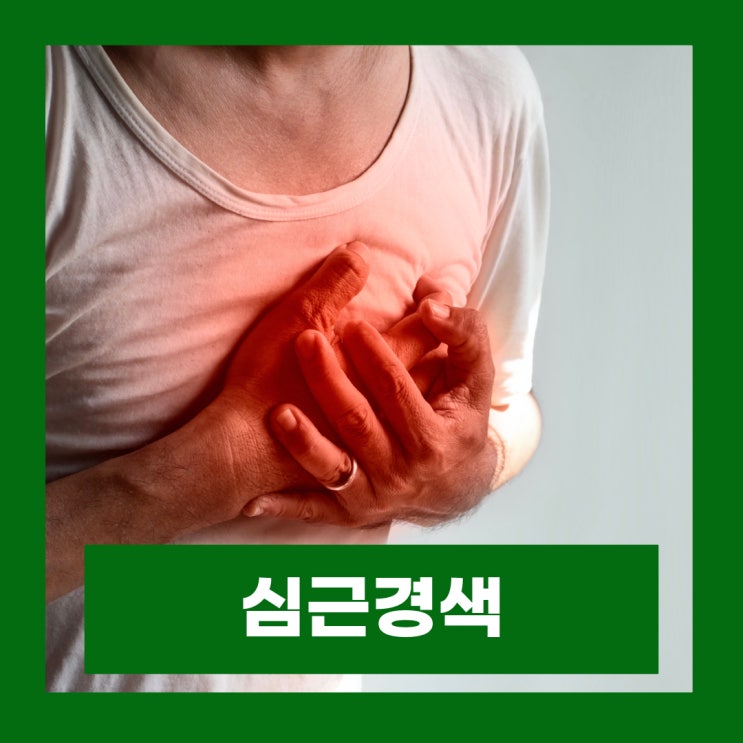  심근경색 원인 예방 전조증상 왼쪽가슴통증 호흡곤란 체함 오한