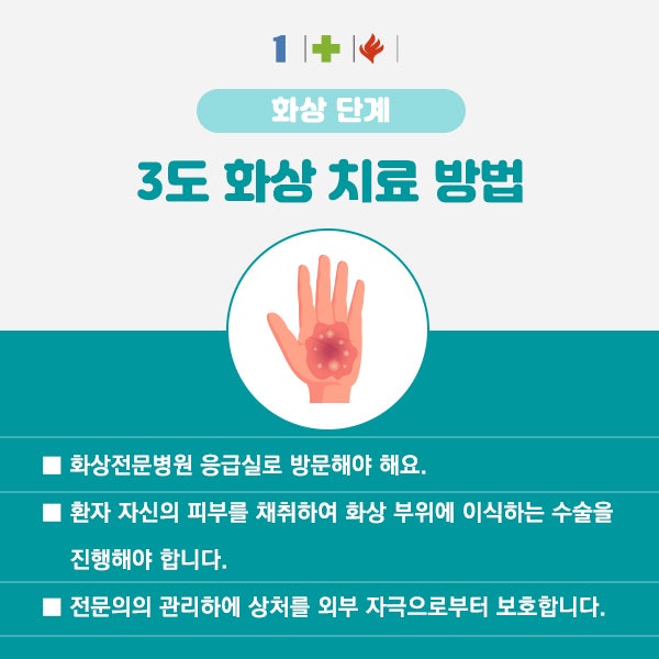 화상 단계, 화상입었을 때 1도, 2도, 3도 화상 단계 및 치료방법 : 네이버 블로그