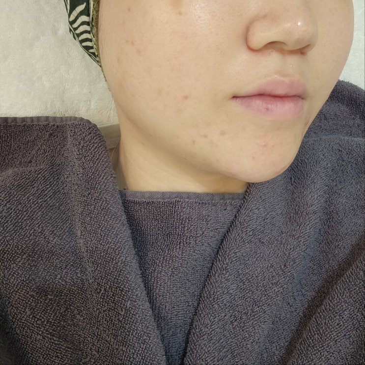 인창동 피부관리 구리 에스테틱진 얼굴 리프팅 예신관리로 추천