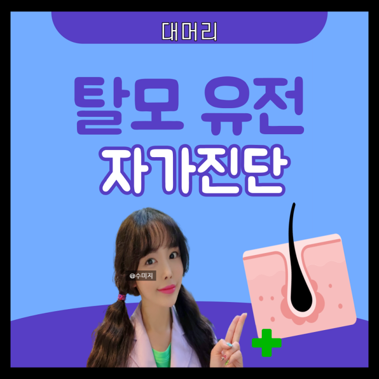  탈모 원인 증상 : 탈모 유전 대머리 초기 증상 자가진단 확인법 진단 20대 30대 탈모예방법