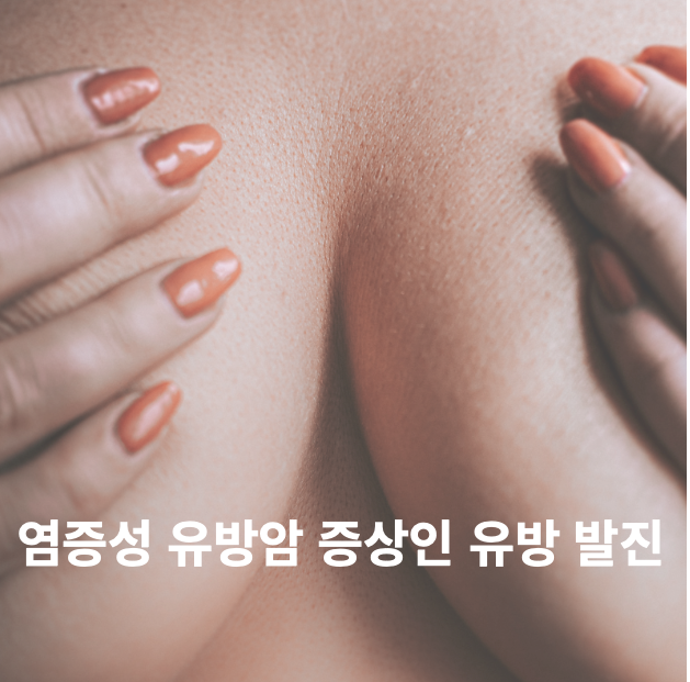  염증성 유방암 증상인 유방 발진