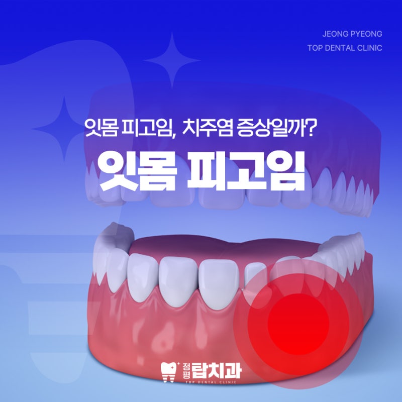 잇몸 피고임 원인 심각한 치주염 증상일까