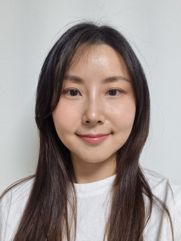 코 성형 수술 2주차 후기, 가격, 붓기 코 성형 수술 2주차 후기, 가격, 붓기