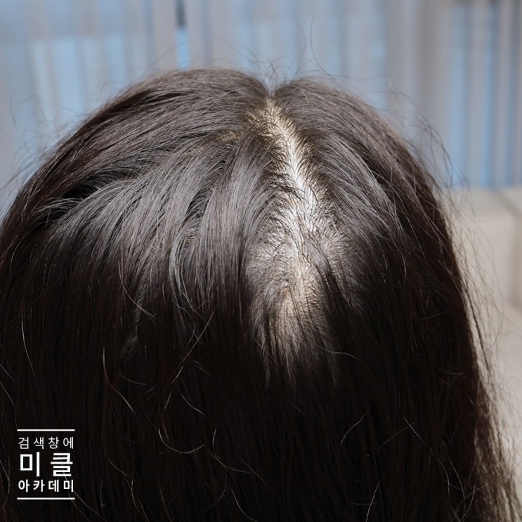  반영구 원형탈모 교육 어떤 테크닉이 좋을까
