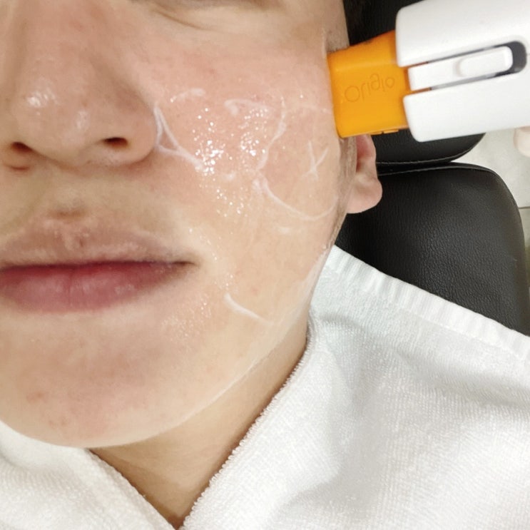 논현 피부과 올리지오 고주파 리프팅 200샷 후기 및 효과 논현 피부과 올리지오 고주파 리프팅 200샷 후기 및 효과