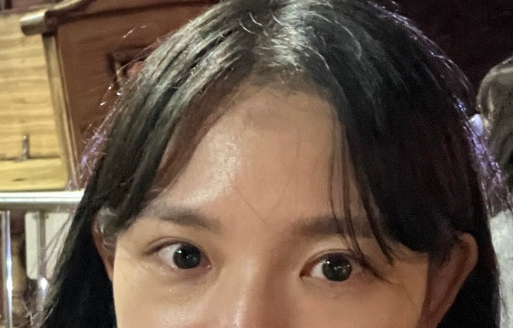  [화상] 고데기에 데임 후 흉터 안남는 방법 꿀팁 _약 1달 (광고없음)