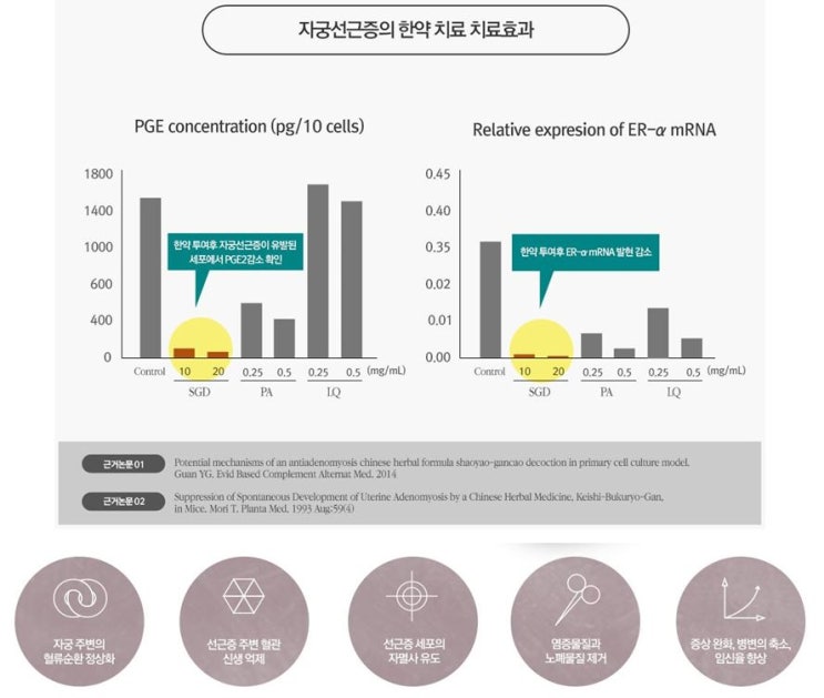  안양평촌자궁선근증 증상이 심한 이유, 한약 치료 후 변화